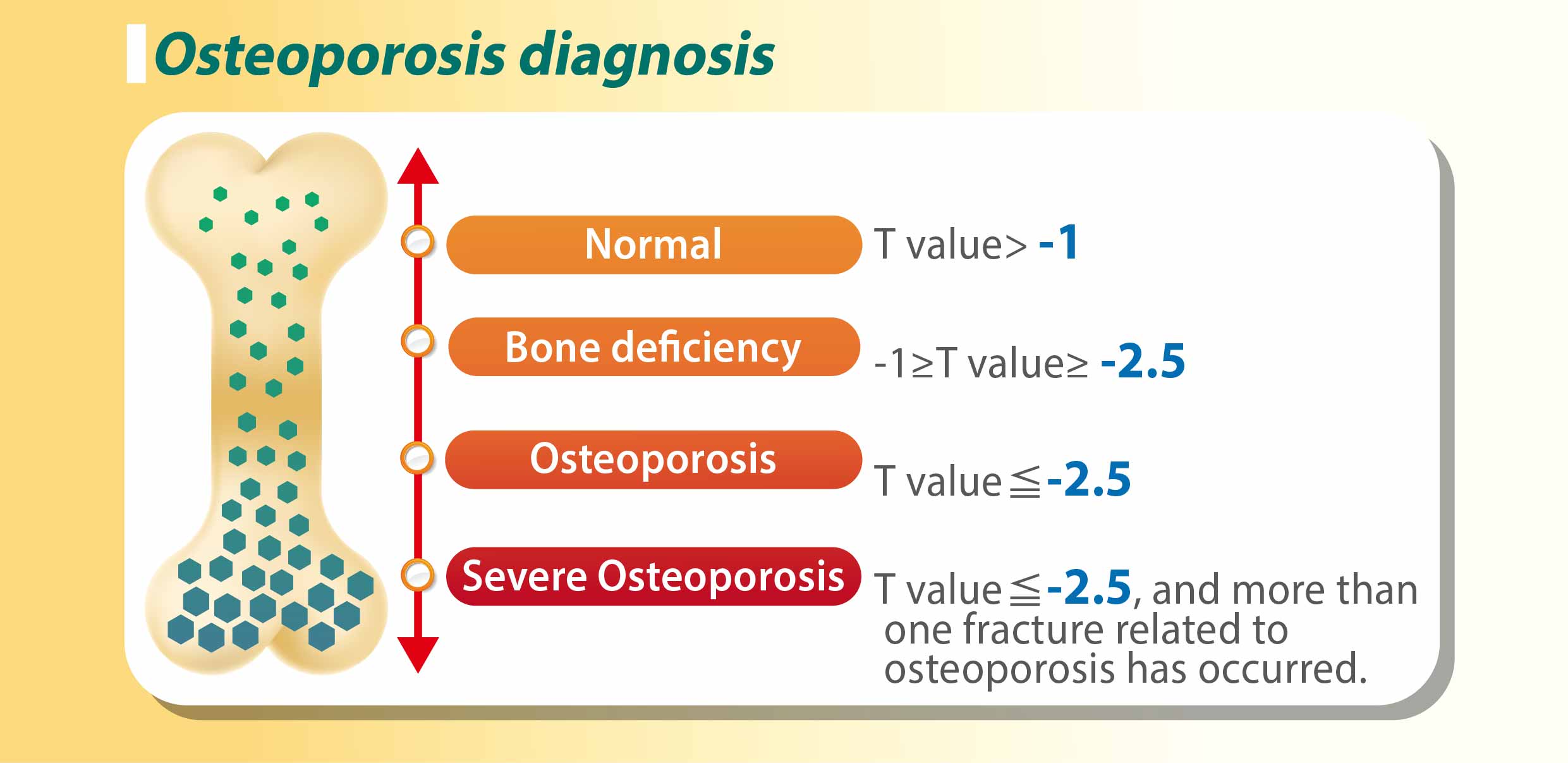  Osteoporosis
